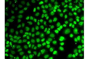 Immunofluorescence analysis of A549 cells using XPO5 antibody (ABIN5974114). (XPO5 抗体)