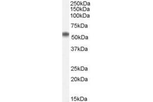Image no. 1 for anti-Nucleus Accumbens Associated 1, BEN and BTB (POZ) Domain Containing (NACC1) (Internal Region) antibody (ABIN190827)