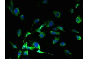 Immunofluorescent analysis of U251 cells using ABIN7166779 at dilution of 1:100 and Alexa Fluor 488-congugated AffiniPure Goat Anti-Rabbit IgG(H+L) (Solute Carrier Family 38, Member 7 (SLC38A7) (AA 1-55) 抗体)