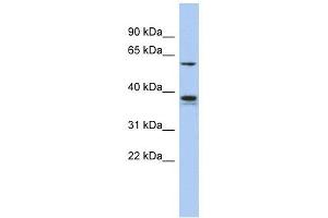 GOPC antibody used at 1 ug/ml to detect target protein. (GOPC 抗体  (Middle Region))