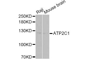 Western blot analysis of extracts of various cell lines, using ATP2C1 Antibody (ABIN5975353) at 1/1000 dilution. (ATP2C1 抗体)
