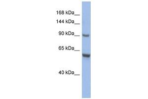 WB Suggested Anti-CIZ1 Antibody Titration:  0.