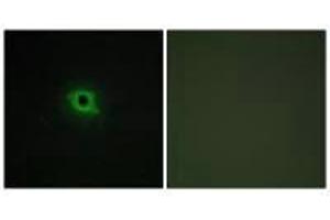 Immunofluorescence analysis of COS-7 cells, using DGKK antibody. (DGKK 抗体  (C-Term))