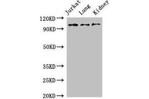 Western Blot Positive WB detected in: Jurkat whole cell lysate, Mouse lung tissue, Mouse kidney tissue All lanes: SMARCAL1 antibody at 3 μg/mL Secondary Goat polyclonal to rabbit IgG at 1/50000 dilution Predicted band size: 106 kDa Observed band size: 106 kDa (SMARCAL1 抗体  (AA 6-277))