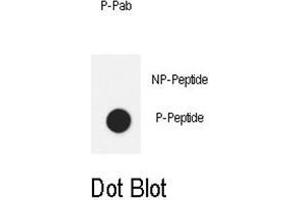 Dot blot analysis of anti-Phospho-IL6ST-Y905 Phospho-specific Pab on nitrocellulose membrane. (CD130/gp130 抗体  (pTyr905))