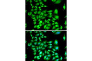 Immunofluorescence analysis of A549 cell using TREX1 antibody. (TREX1 抗体)