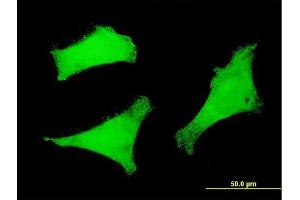 Immunofluorescence of monoclonal antibody to FOXO3 on HeLa cell. (FOXO3 抗体  (AA 361-460))