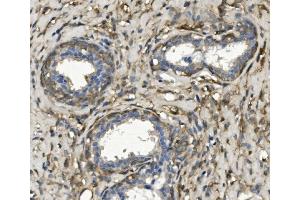 IHC analysis of non-muscle Myosin IIB/MYH10 using anti-non-muscle Myosin IIB/MYH10 antibody (ABIN7603186). (MYH10 抗体  (N-Term))