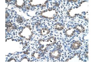 Ankyrin 1 antibody was used for immunohistochemistry at a concentration of 4-8 ug/ml to stain Alveolar cells (arrows) in Human Lung. (Erythrocyte Ankyrin 抗体  (C-Term))