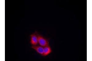 Image no. 1 for anti-VEGF Receptor 2 (VEGFR2) (AA 949-953) antibody (ABIN197240) (VEGFR2/CD309 抗体  (AA 949-953))