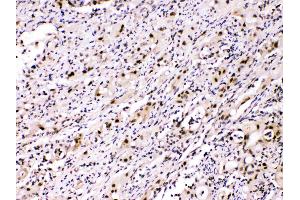 IHC analysis of ATP citrate lyase using anti- ATP citrate lyase antibody . (ACLY 抗体  (AA 1-180))