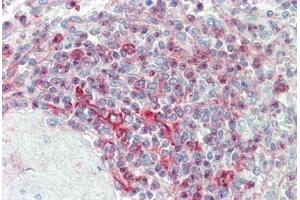Human Spleen: Formalin-Fixed, Paraffin-Embedded (FFPE) (CLK4 抗体  (AA 101-150))