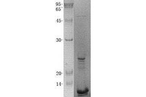 Validation with Western Blot (WBP1 Protein (His tag))