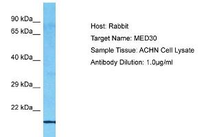 Host: Rabbit Target Name: MED30 Sample Type: ACHN Whole Cell lysates Antibody Dilution: 1. (MED30 抗体  (C-Term))
