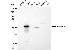 Western blotting analysis using keratin 7 antibody (ABIN7799188).