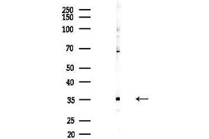 anti-Probable U3 Small Nucleolar RNA-Associated Protein 11 (UTP11) antibody