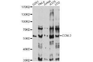 Western blot analysis of extracts of various cell lines, using CCNL2 antibody (ABIN6290271) at 1:1000 dilution. (Cyclin L2 抗体)