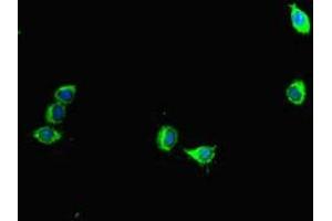 Immunofluorescent analysis of Hela cells using ABIN7145075 at dilution of 1:100 and Alexa Fluor 488-congugated AffiniPure Goat Anti-Rabbit IgG(H+L) (Aurora A 抗体  (AA 1-131))