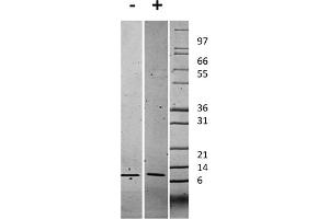 SDS-PAGE of Human Gro Alpha (CXCL1) Recombinant Protein SDS-PAGE of Human Gro Alpha (CXCL1) Recombinant Protein. (CXCL1 蛋白)