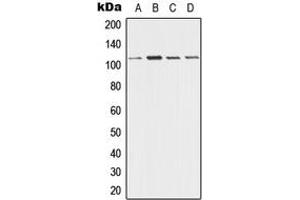 Western blot analysis of Desmoglein 3 expression in A431 (A), HeLa (B), Raw264. (Desmoglein 3 抗体  (Center))