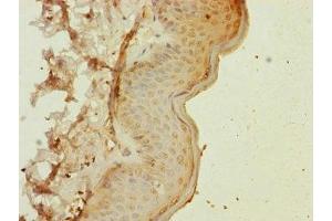 Immunohistochemistry of paraffin-embedded human skin tissue using ABIN7160531 at dilution of 1:100 (MYL1 抗体  (AA 1-150))