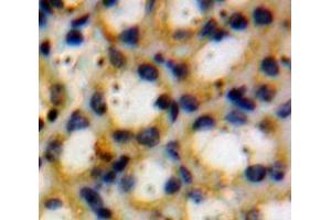 Used in DAB staining on fromalin fixed paraffin-embedded Kidney tissue (Thyroperoxidase 抗体  (AA 636-832))