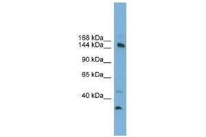 MED14 antibody used at 0. (MED14 抗体  (Middle Region))