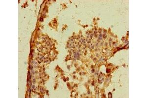Immunohistochemistry of paraffin-embedded human testis tissue using ABIN7164461 at dilution of 1:100 (GPR156 抗体  (AA 614-814))