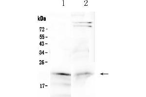 Western blot analysis of Cytoglobin using anti-Cytoglobin antibody . (CYGB 抗体  (AA 1-190))