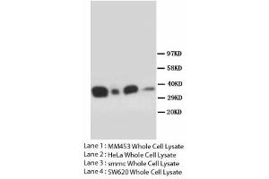 Image no. 1 for anti-Forkhead Box L2 (FOXL2) (N-Term) antibody (ABIN1495192) (FOXL2 抗体  (N-Term))