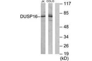 Western blot analysis of extracts from Jurkat/COLO205 cells, using DUSP16 Antibody. (DUSP16 抗体  (AA 571-620))