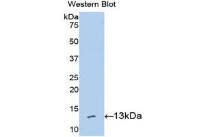 Western Blotting (WB) image for anti-High Mobility Group AT-Hook 1 (HMGA1) (AA 1-107) antibody (ABIN1078143) (HMGA1 抗体  (AA 1-107))