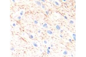 IHC-P analysis of Human Tissue, with DAB staining. (SLC6A3 抗体  (AA 562-620))