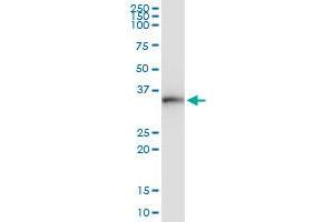 anti-Major Histocompatibility Complex, Class II, DO beta (HLA-DOB) (AA 1-273) antibody