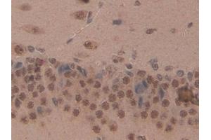 Detection of CD2AP in Rat Brain Tissue using Polyclonal Antibody to CD2 Associated Protein (CD2AP)