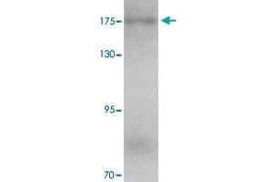 Western blot analysis of KIAA0196 in human ovary tissue with KIAA0196 polyclonal antibody  at 1 ug/mL. (Strumpellin 抗体  (C-Term))
