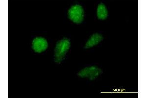Immunofluorescence of purified MaxPab antibody to ZNFN1A2 on HeLa cell. (IKZF2 抗体  (AA 1-500))