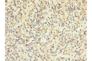 Immunohistochemistry of paraffin-embedded human spleen tissue using ABIN7175617 at dilution of 1:100 (HVCN1 抗体  (AA 1-100))