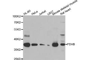 Western blot analysis of extracts of various cell lines, using PDHB antibody (ABIN5975451) at 1/1000 dilution. (PDHB 抗体)