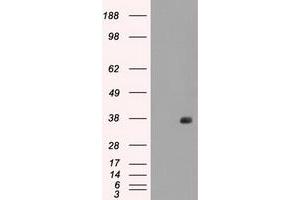 Image no. 2 for anti-Fc gamma RII (CD32) antibody (ABIN1497255) (Fc gamma RII (CD32) 抗体)