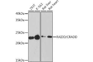 Western blot analysis of extracts of various cell lines, using RAIDD/CRADD Rabbit mAb (ABIN7266107) at 1:1000 dilution. (CRADD 抗体)
