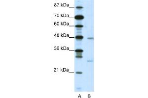 WB Suggested Anti-MXD4 Antibody   Titration: 2. (MXD4 抗体  (N-Term))