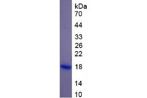 SDS-PAGE of Protein Standard from the Kit (Highly purified E. (RPN1 ELISA 试剂盒)