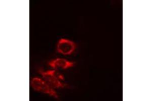 ABIN6274823 staining COLO205 cells by IF/ICC. (AKR1A1 抗体  (C-Term))