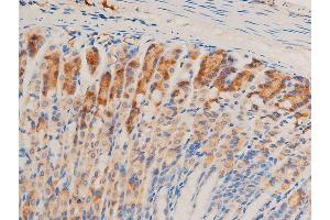 ABIN6267067 at 1/100 staining mouse gastric tissue sections by IHC-P. (TGFB1 抗体  (C-Term))