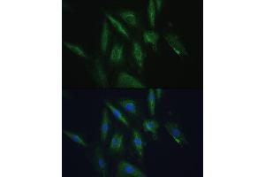 Immunofluorescence analysis of H9C2 cells using SRPRB antibody (ABIN6132685, ABIN6148459, ABIN6148460 and ABIN6214895) at dilution of 1:100. (SRPRB 抗体  (AA 57-271))