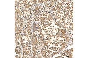 IHC analysis of Citrin/SLC25A13 using anti-Citrin/SLC25A13 antibody (ABIN7599512). (slc25a13 抗体  (AA 1-643))