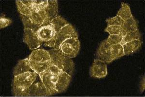 Immunofluorescence staining of A431 cells. (RABEP1 抗体  (AA 247-417))