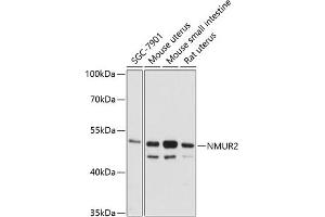 Western blot analysis of extracts of various cell lines, using NMUR2 antibody (ABIN6128345, ABIN6144693, ABIN6144694 and ABIN6216572) at 1:3000 dilution. (NMUR2 抗体  (AA 326-415))