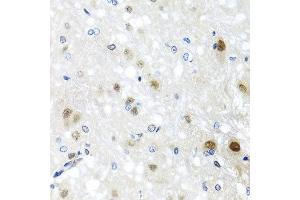 Immunohistochemistry of paraffin-embedded rat brain using SAFB2 antibody at dilution of 1:100 (x40 lens). (SAFB2 抗体)
